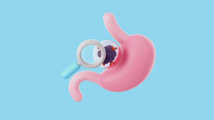 gastroenterologie-cu-bilet-de-trimitere Consult la gastroenterolog cu bilet de trimitere: ce trebuie să știi